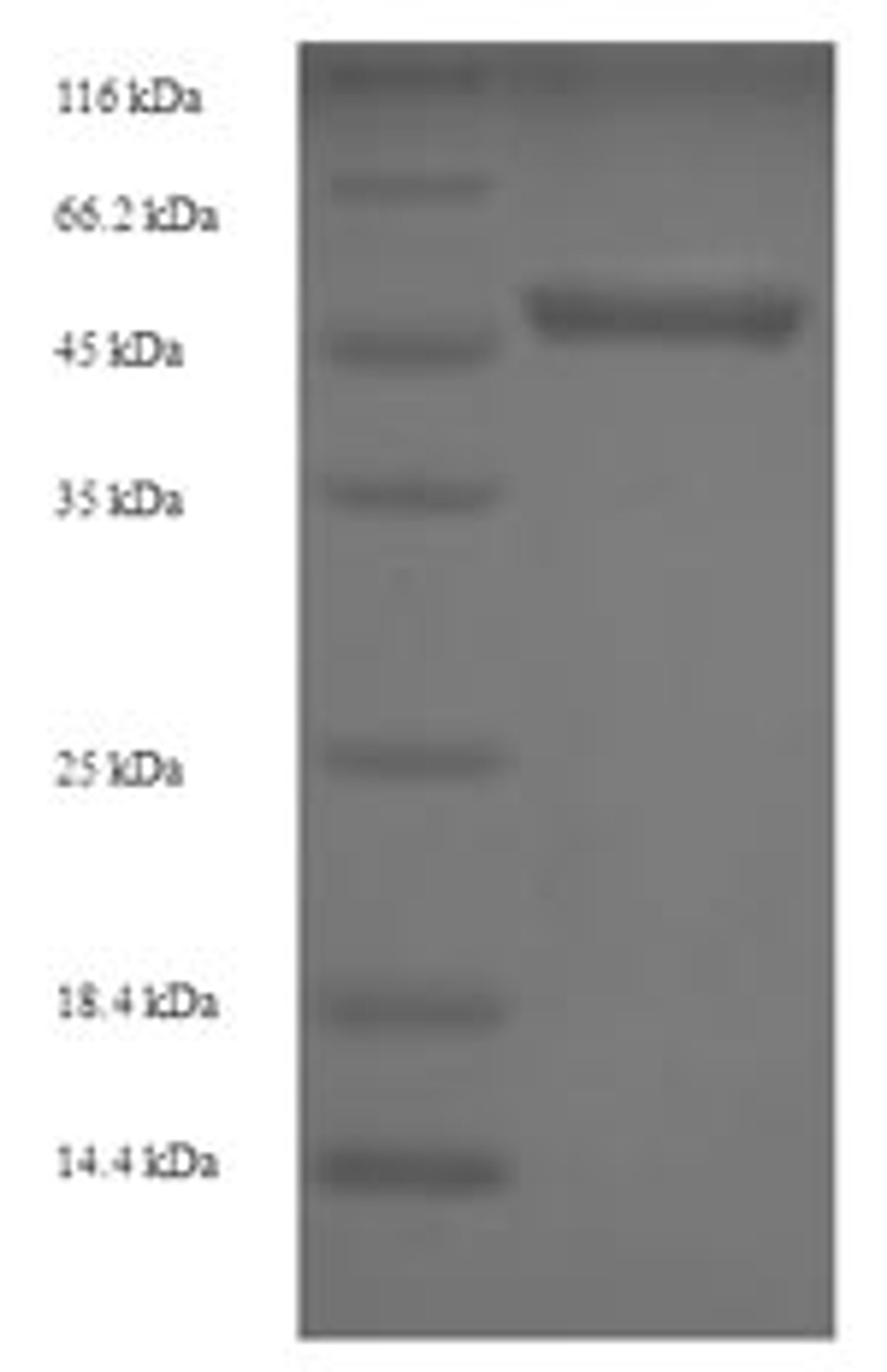 (Tris-Glycine gel) Discontinuous SDS-PAGE (reduced) with 5% enrichment gel and 15% separation gel.
