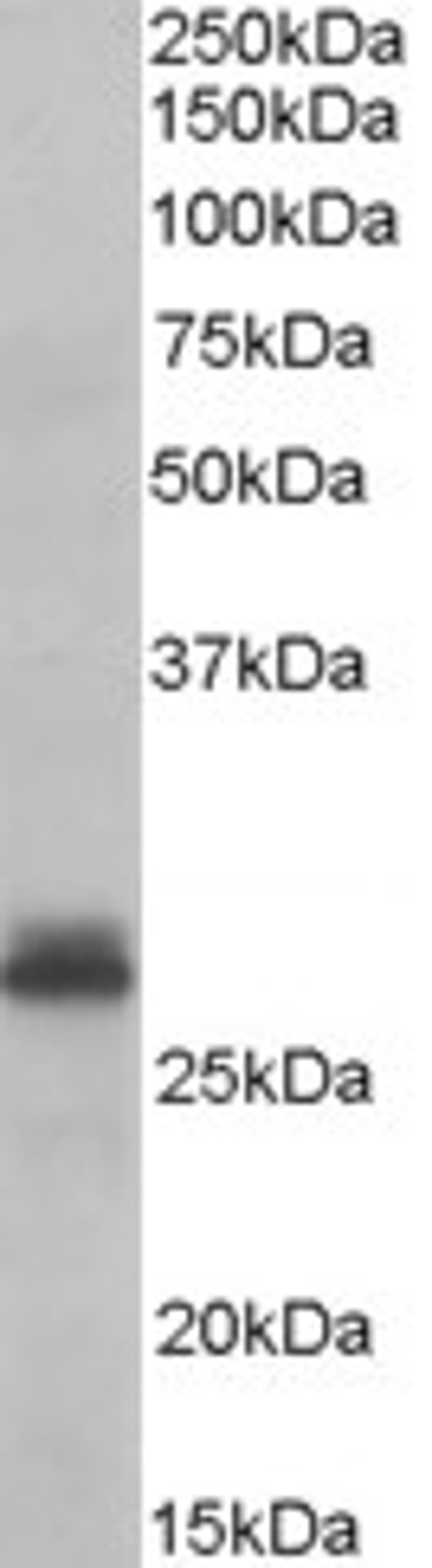 46-466 (0.3ug/ml) staining of Human Heart lysate (35ug protein in RIPA buffer). Primary incubation was 1 hour. Detected by chemiluminescence.