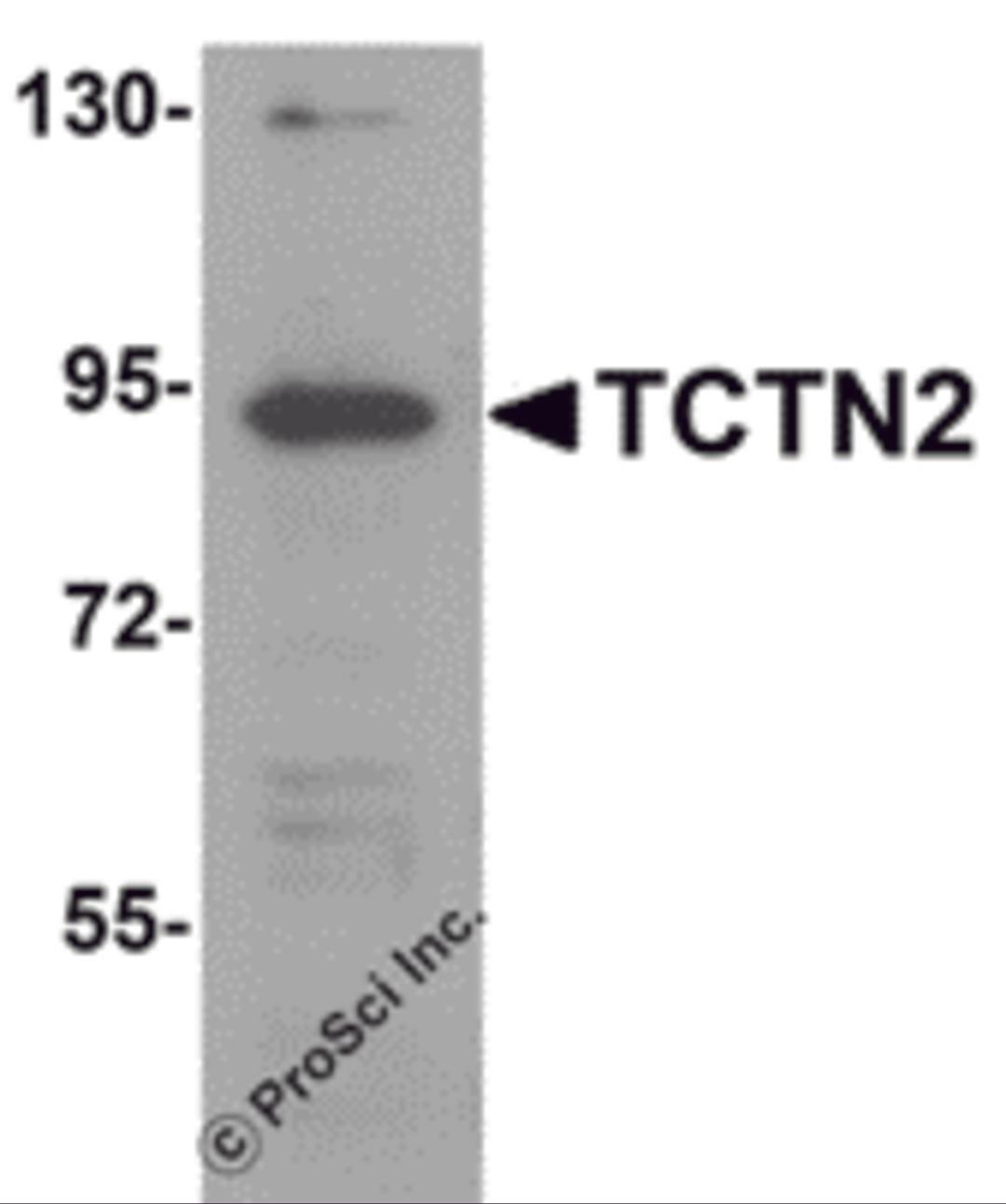 Western blot analysis of TCTN2 in SK-N-SH cell lysate with TCTN2 antibody at 1 μg/mL.