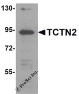 Western blot analysis of TCTN2 in SK-N-SH cell lysate with TCTN2 antibody at 1 μg/mL.