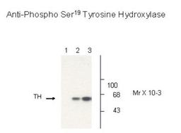 Western Blot: Tyrosine Hydroxylase [p Ser19] Antibody [NB300-212] - Non-phospho-recombinant tyrosine hydroxylase (Lane 1), PC-12 cell lysate (Lane 2), and PC-12 cell lysate stimulated with KCl, 30 mM for 10 min (Lane 3) showing specific immunolabeling of the ~60k tyrosine hydroxylase phosphorylated at Ser19.