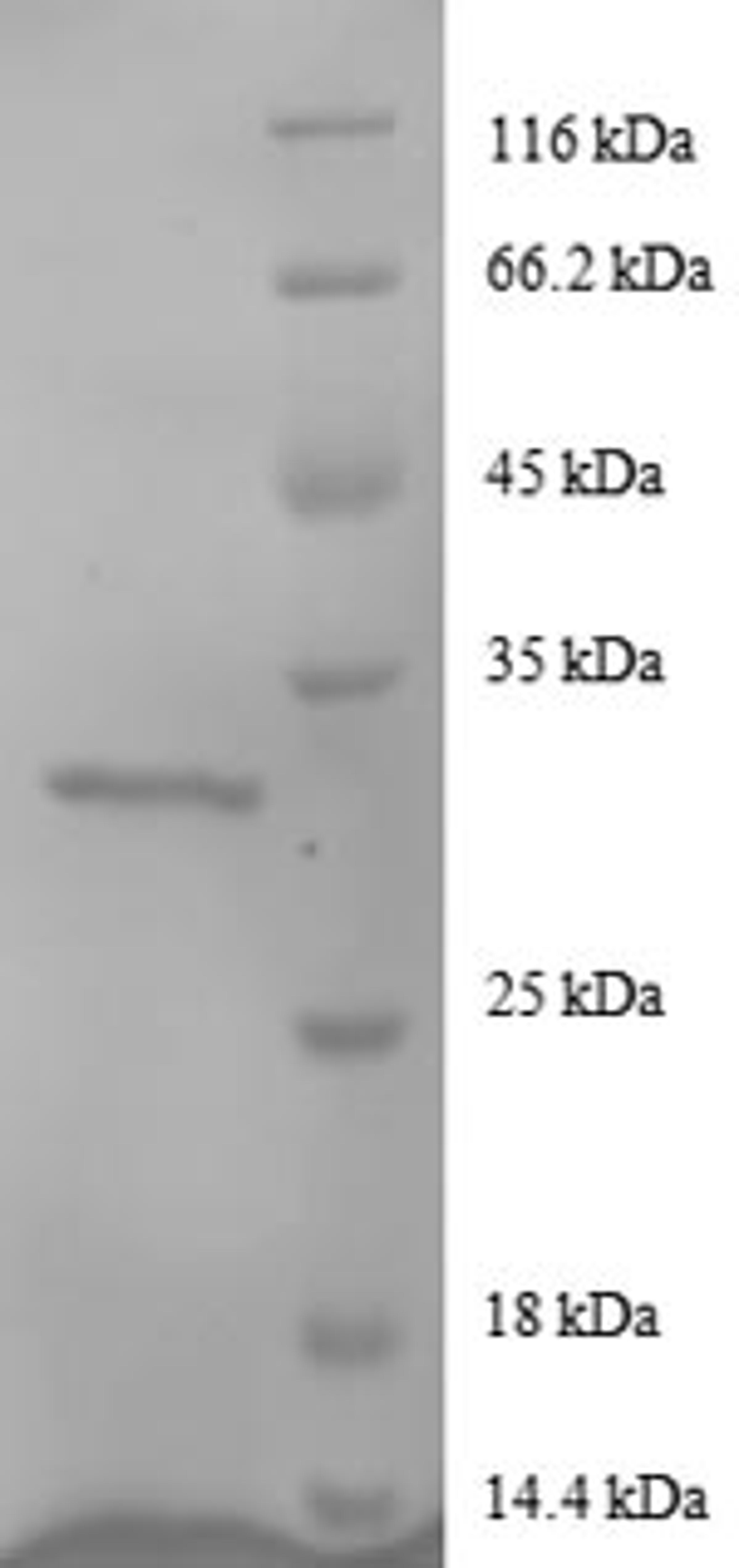 (Tris-Glycine gel) Discontinuous SDS-PAGE (reduced) with 5% enrichment gel and 15% separation gel.
