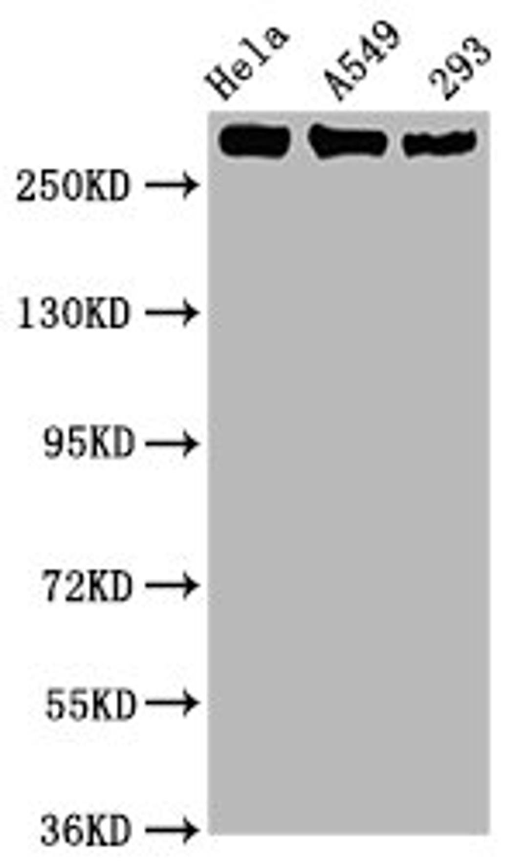 Western Blot. Positive WB detected in Hela whole cell lysate,A549 whole cell lysate,293 whole cell lysate. All lanes Phospho-POLR2A antibody at 1.02μg/ml. Secondary. Goat polyclonal to rabbit IgG at 1/50000 dilution. Predicted band size: 270 KDa. Observed band size: 270 KDa. 