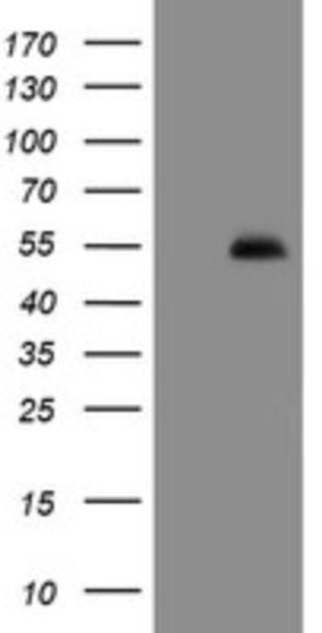 Western Blot: PHF7 Antibody (1G9) [NBP2-45881] - Analysis of HEK293T cells were transfected with the pCMV6-ENTRY control (Left lane) or pCMV6-ENTRY PHF7.