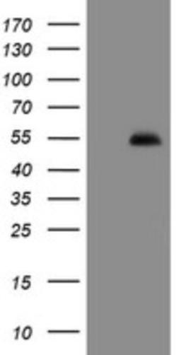 Western Blot: PHF7 Antibody (1G9) [NBP2-45881] - Analysis of HEK293T cells were transfected with the pCMV6-ENTRY control (Left lane) or pCMV6-ENTRY PHF7.