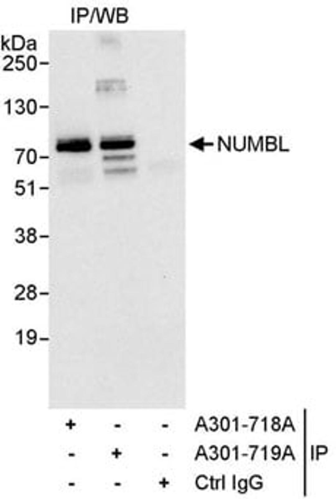 Detection of human NUMBL1 by western blot of immunoprecipitates.