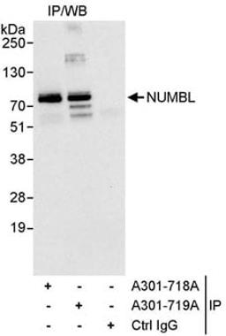 Detection of human NUMBL1 by western blot of immunoprecipitates.