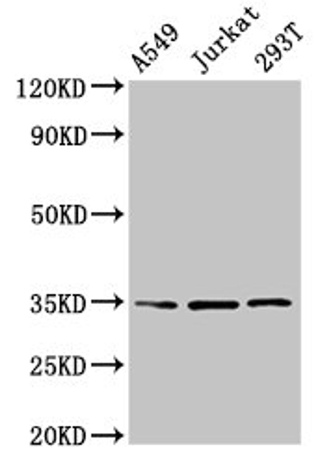 Western Blot. Positive WB detected in: A549 whole cell lysate, Jurkat whole cell lysate, 293T whole cell lysate. All lanes: MAGEA3 antibody at 4µg/ml. Secondary. Goat polyclonal to rabbit IgG at 1/50000 dilution. Predicted band size: 35 kDa. Observed band size: 35 kDa