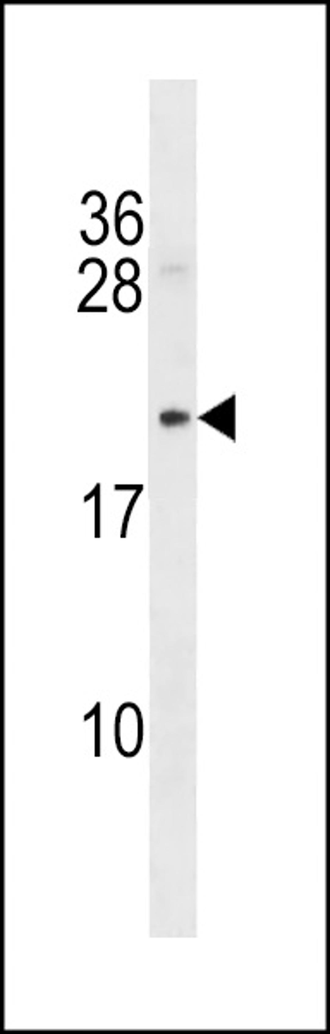 Western blot analysis in mouse bladder tissue lysates (35ug/lane).This demonstrates detected the Mycb protein (arrow).