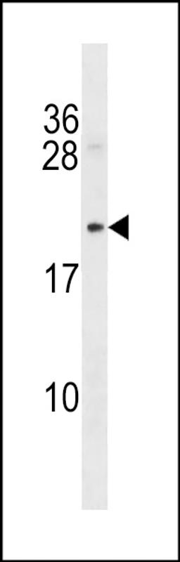 Western blot analysis in mouse bladder tissue lysates (35ug/lane).This demonstrates detected the Mycb protein (arrow).