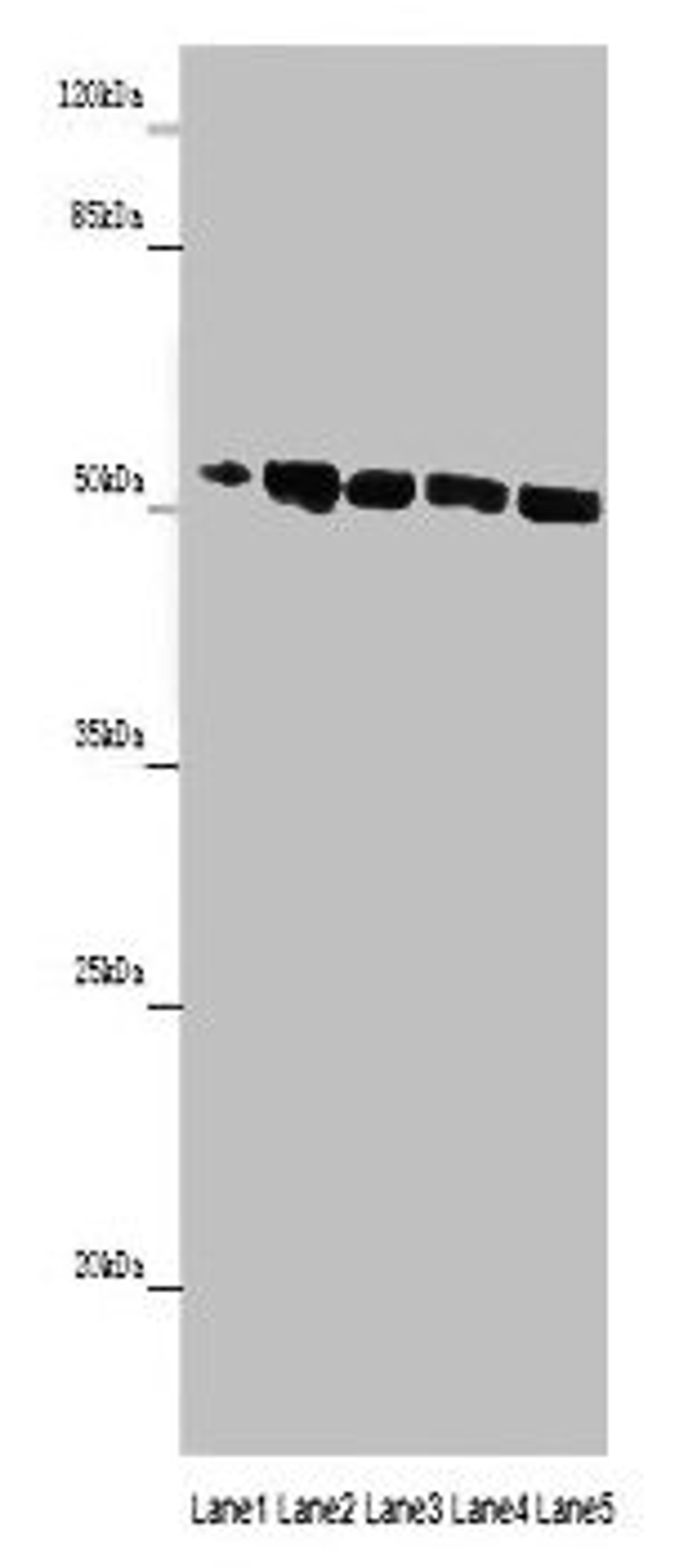 Western blot. All lanes: MINPP1 antibody at 14ug/ml. Lane 1: Jurkat whole cell lysate. Lane 2: U251 whole cell lysate. Lane 3: K562 whole cell lysate. Lane 4: Hela whole cell lysate. Lane 5: HepG2 whole cell lysate. Secondary. Goat polyclonal to rabbit IgG at 1/10000 dilution. Predicted band size: 56, 35, 32, 34 kDa. Observed band size: 56 kDa. 