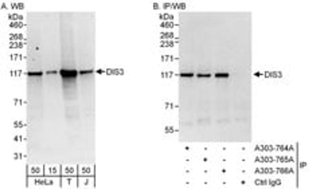 Detection of human DIS3 by western blot and immunoprecipitation.