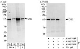 Detection of human DIS3 by western blot and immunoprecipitation.