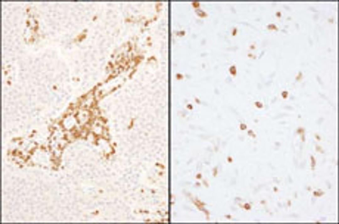 Detection of human and mouse Coronin 1 by immunohistochemistry.