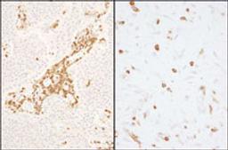 Detection of human and mouse Coronin 1 by immunohistochemistry.