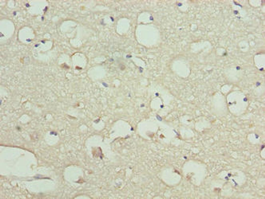 Immunohistochemistry of paraffin-embedded human brain tissue using CSB-PA816919LA01HU at dilution of 1:100