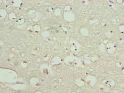 Immunohistochemistry of paraffin-embedded human brain tissue using CSB-PA816919LA01HU at dilution of 1:100