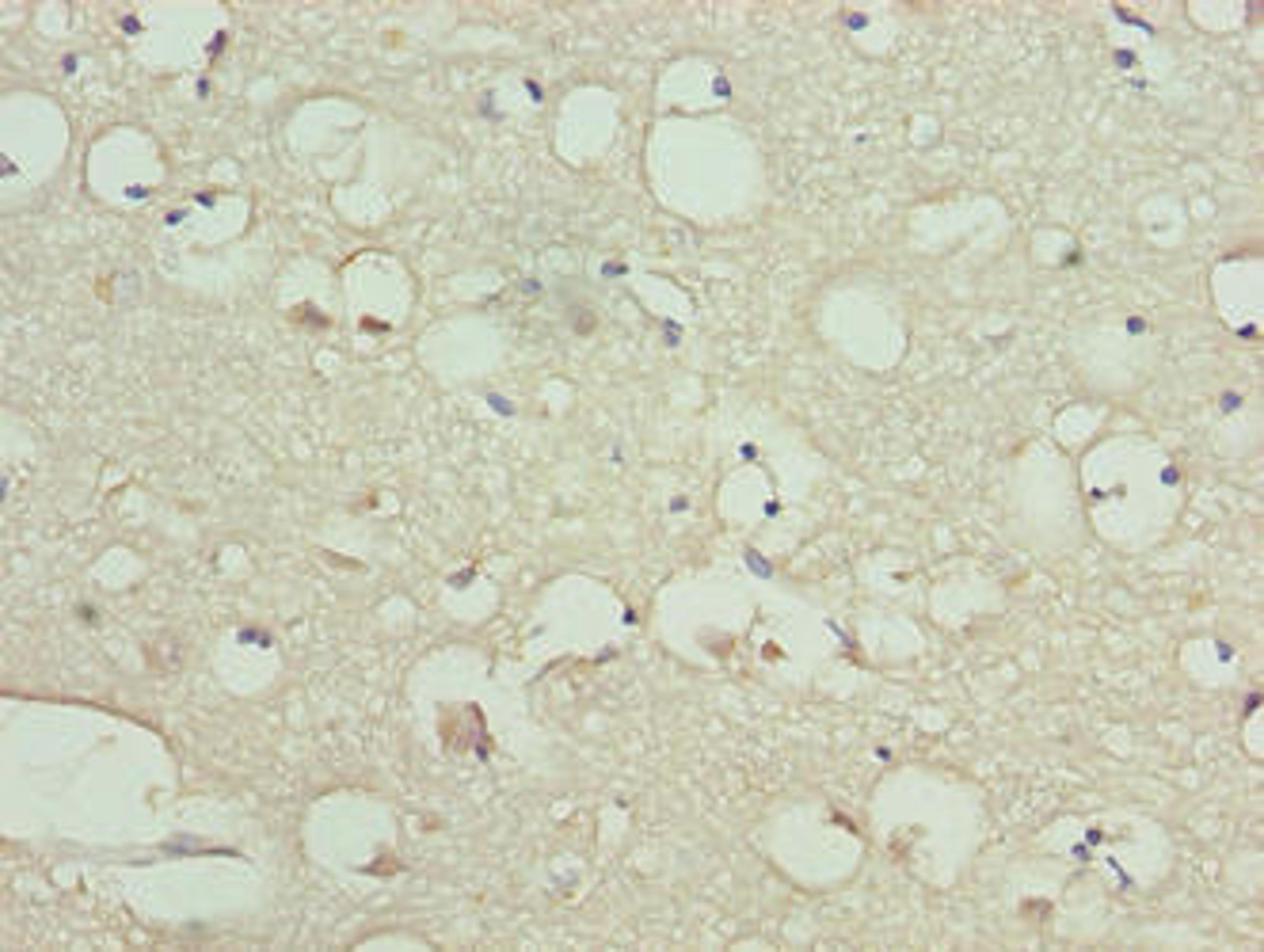 Immunohistochemistry of paraffin-embedded human brain tissue using CSB-PA816919LA01HU at dilution of 1:100