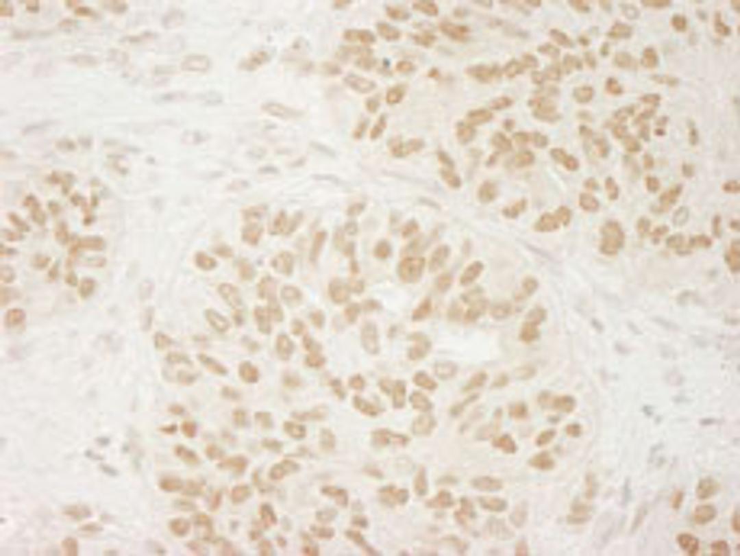 Detection of human USP33 by immunohistochemistry.