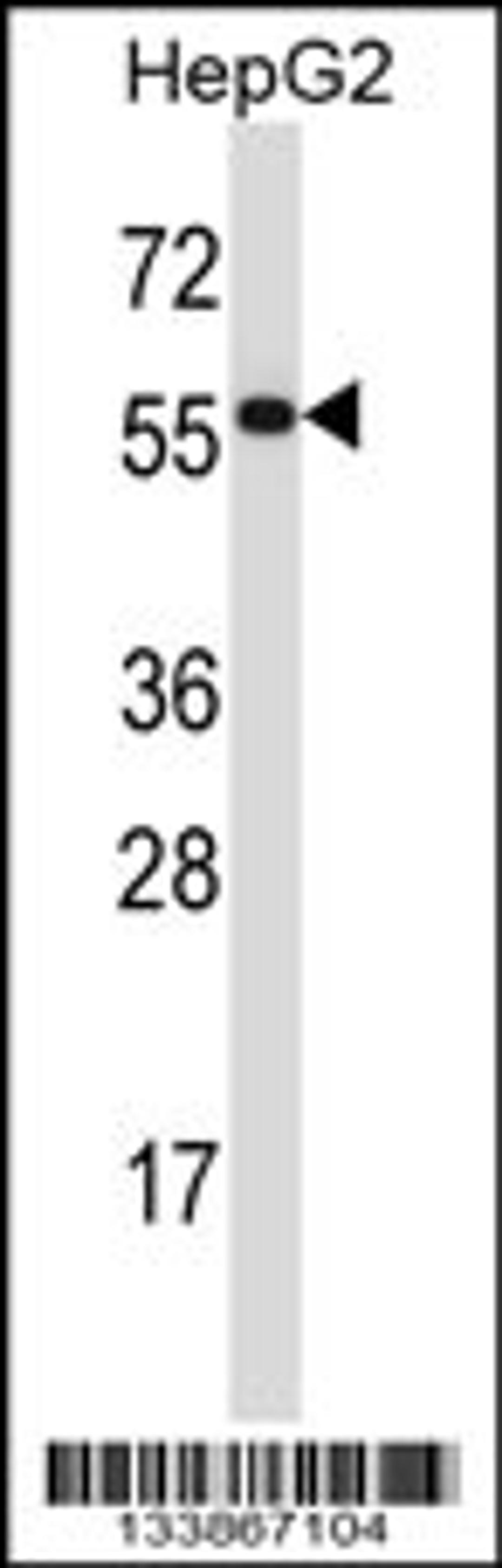 Western blot analysis in HepG2 cell line lysates (35ug/lane).