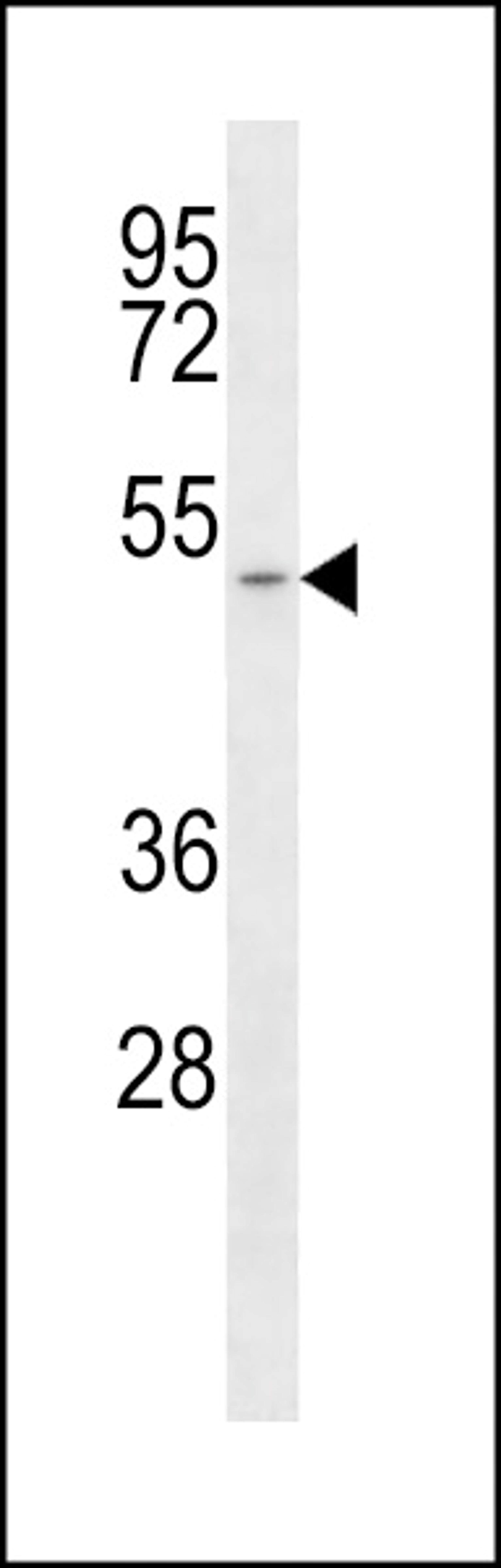 Western blot analysis of anti-SLC16A1 Antibody in T47D cell line lysates (35ug/lane).