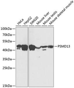 Western blot - PSMD13 Antibody (A12485)