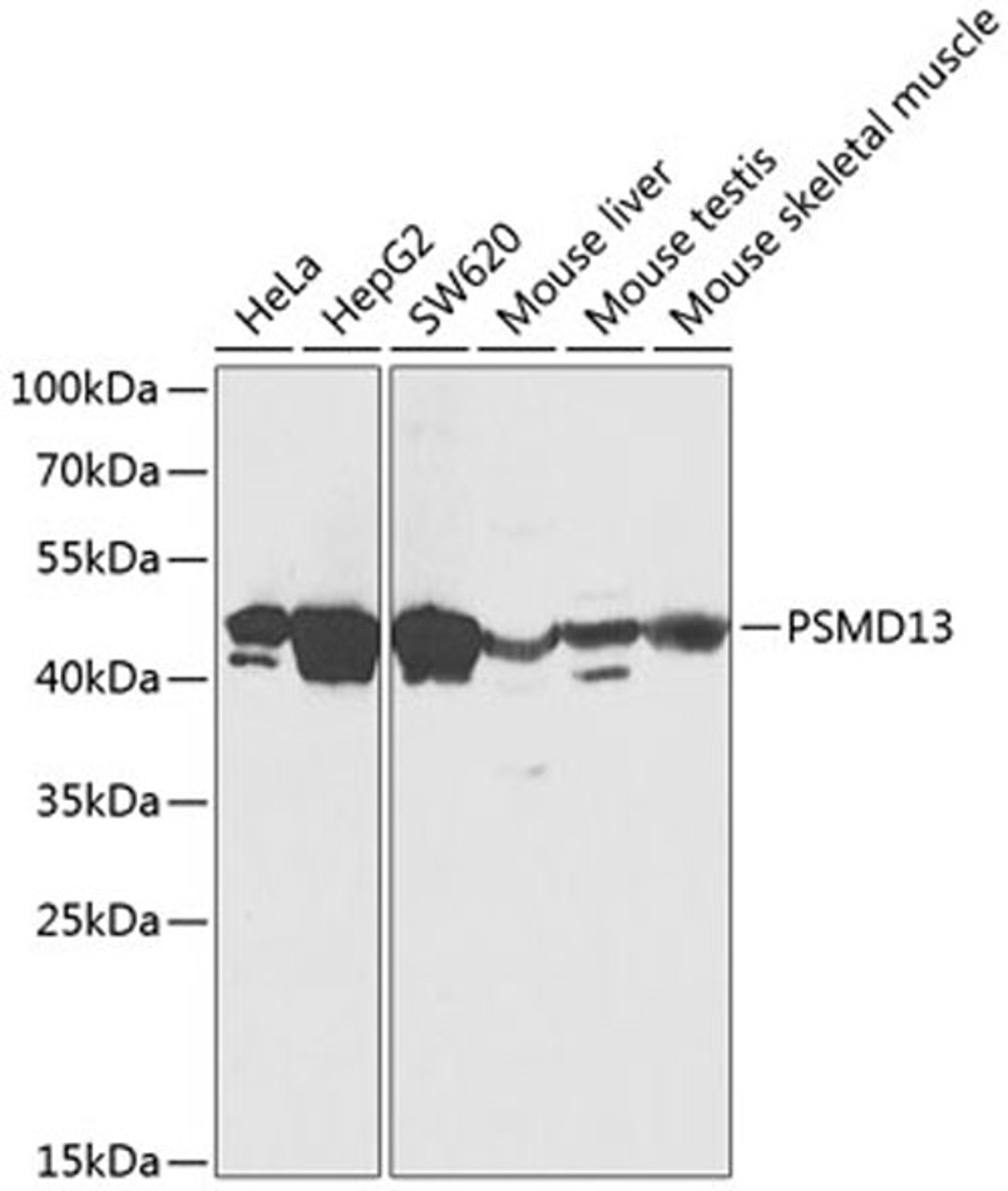 Western blot - PSMD13 Antibody (A12485)