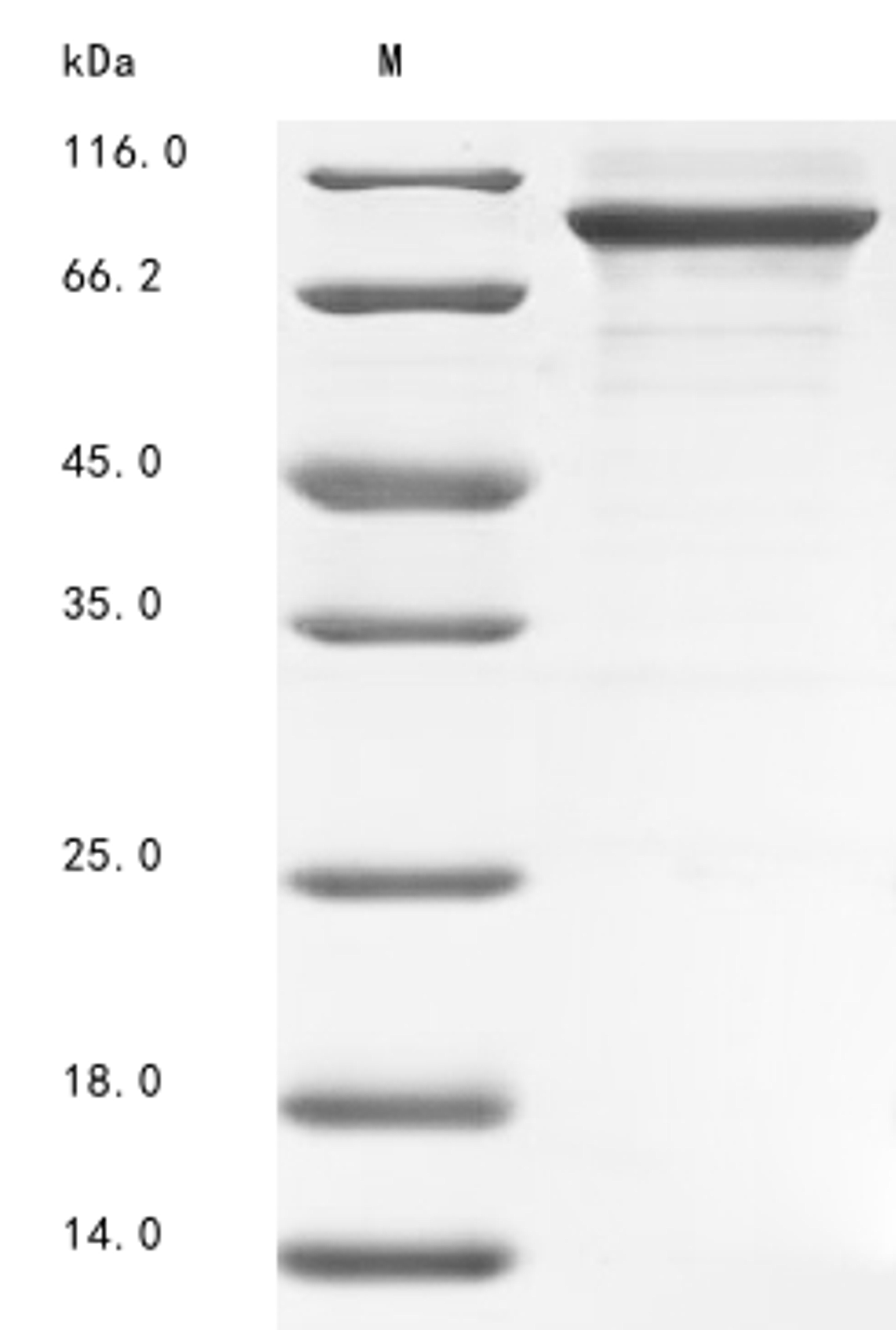 (Tris-Glycine gel) Discontinuous SDS-PAGE (reduced) with 5% enrichment gel and 15% separation gel.