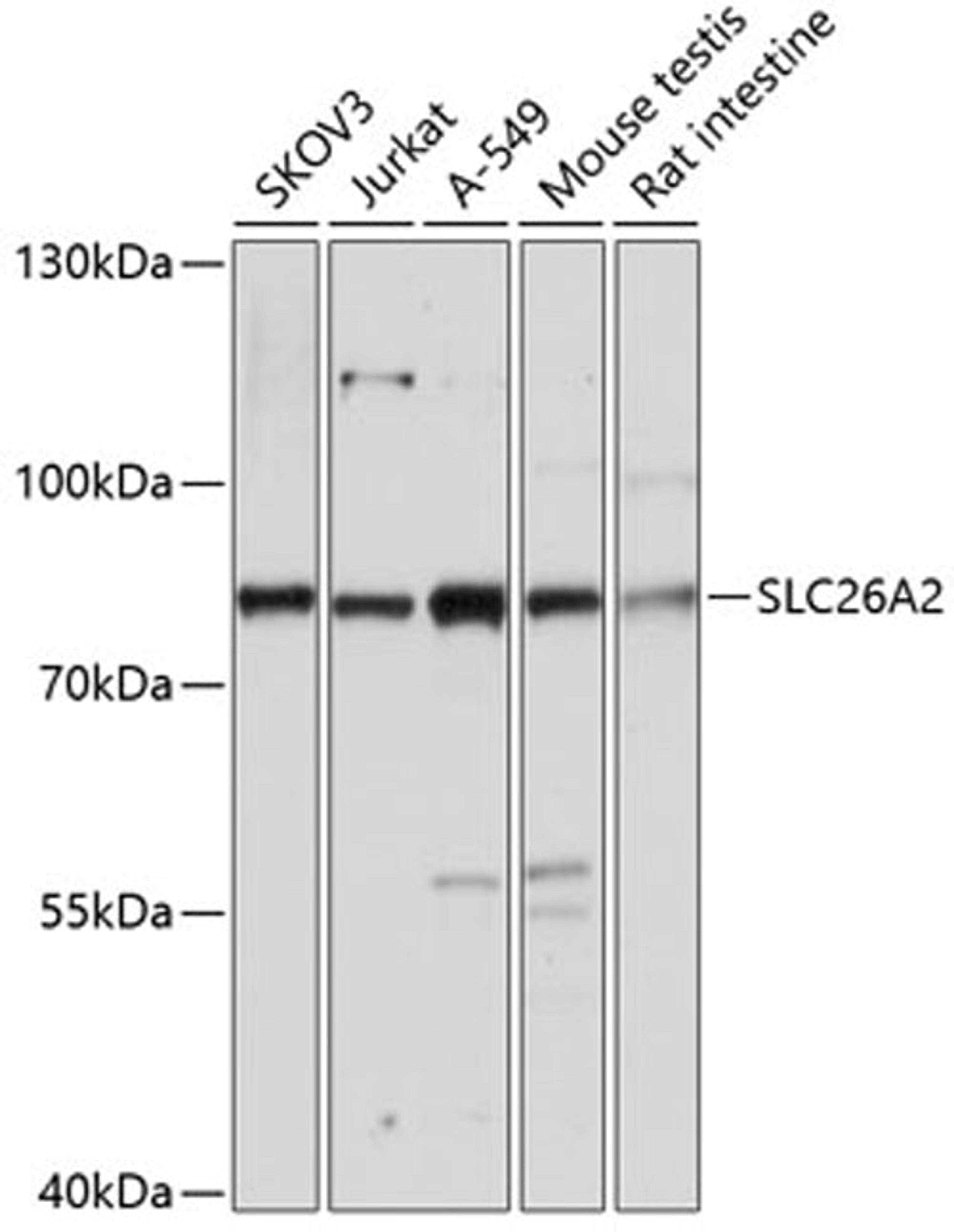 Western blot - SLC26A2 antibody (A14561)