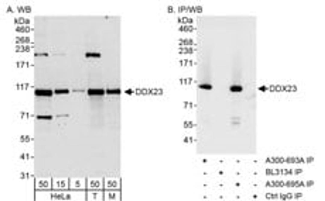 Detection of human and mouse DDX23 by western blot (h&m) and immunoprecipitation (h).