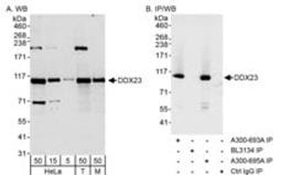 Detection of human and mouse DDX23 by western blot (h&m) and immunoprecipitation (h).