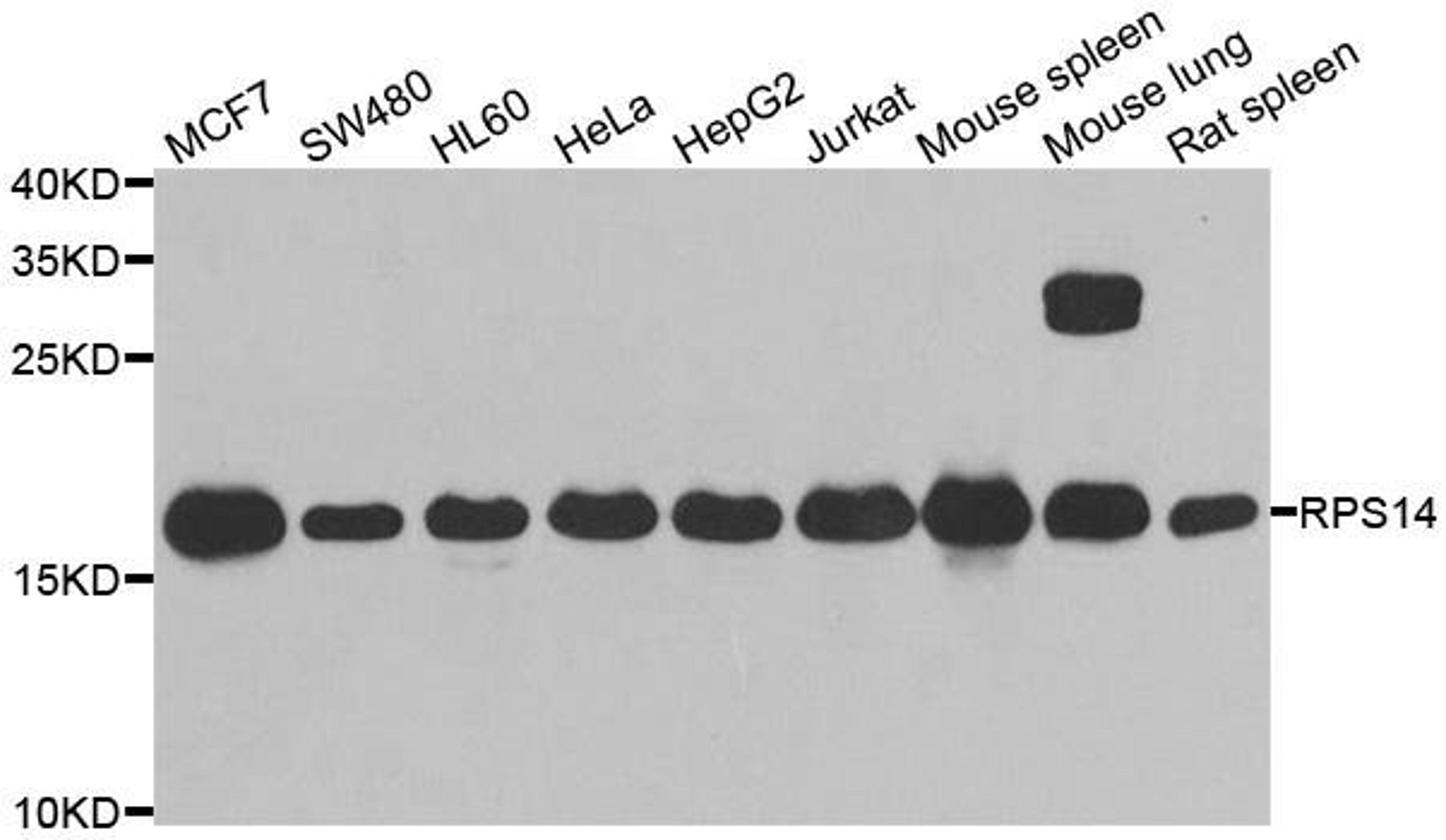 Western blot analysis of extracts of various cell lines using RPS14 antibody