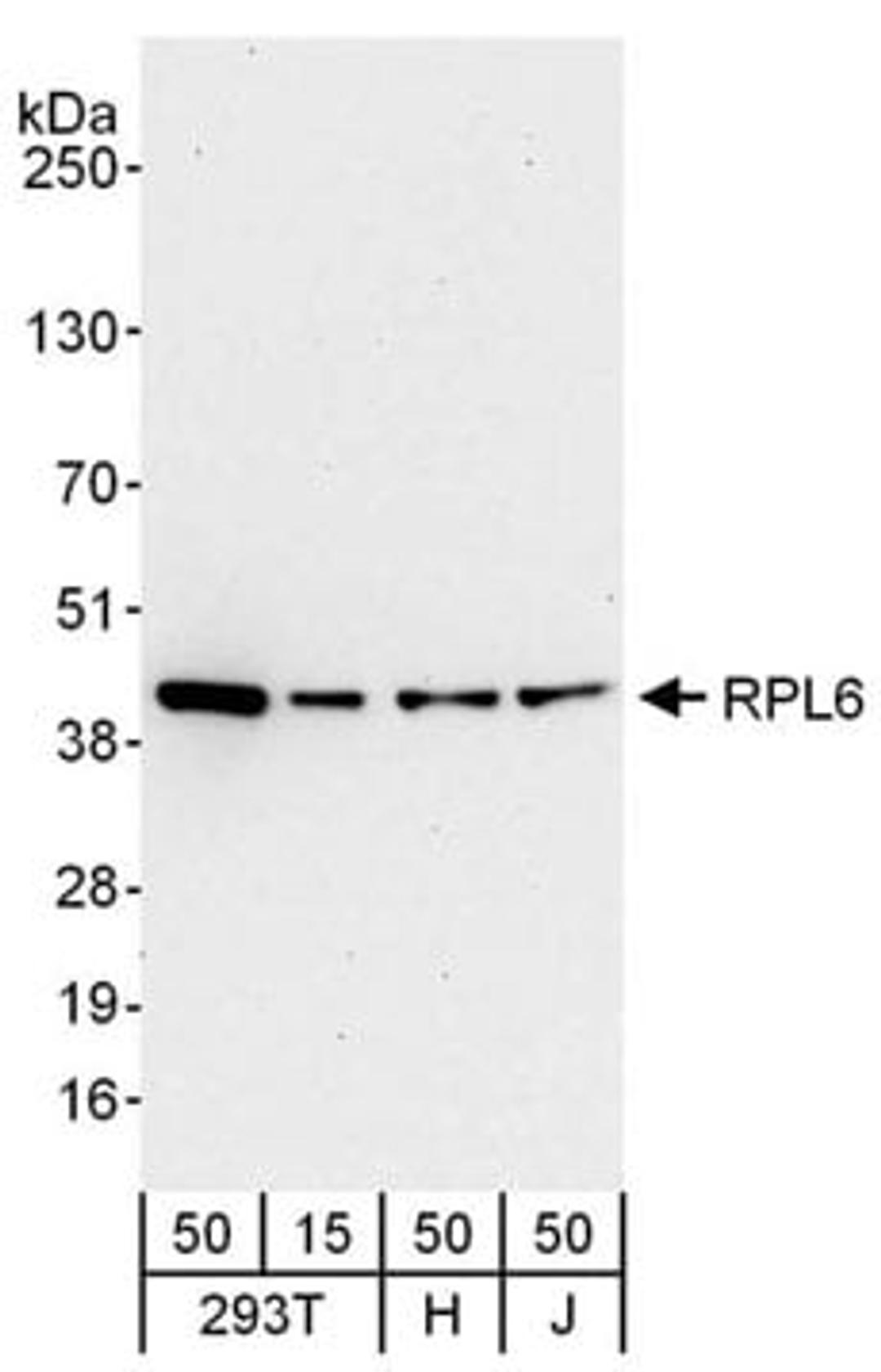 Detection of human RPL6 by western blot.