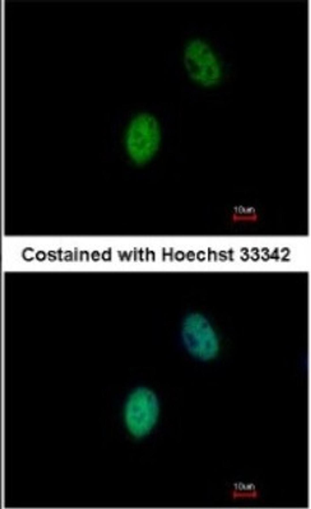 Immunocytochemistry/Immunofluorescence: FHL5 Antibody [NBP1-32660] - Paraformaldehyde-fixed HeLa, using antibody at 1:500 dilution.