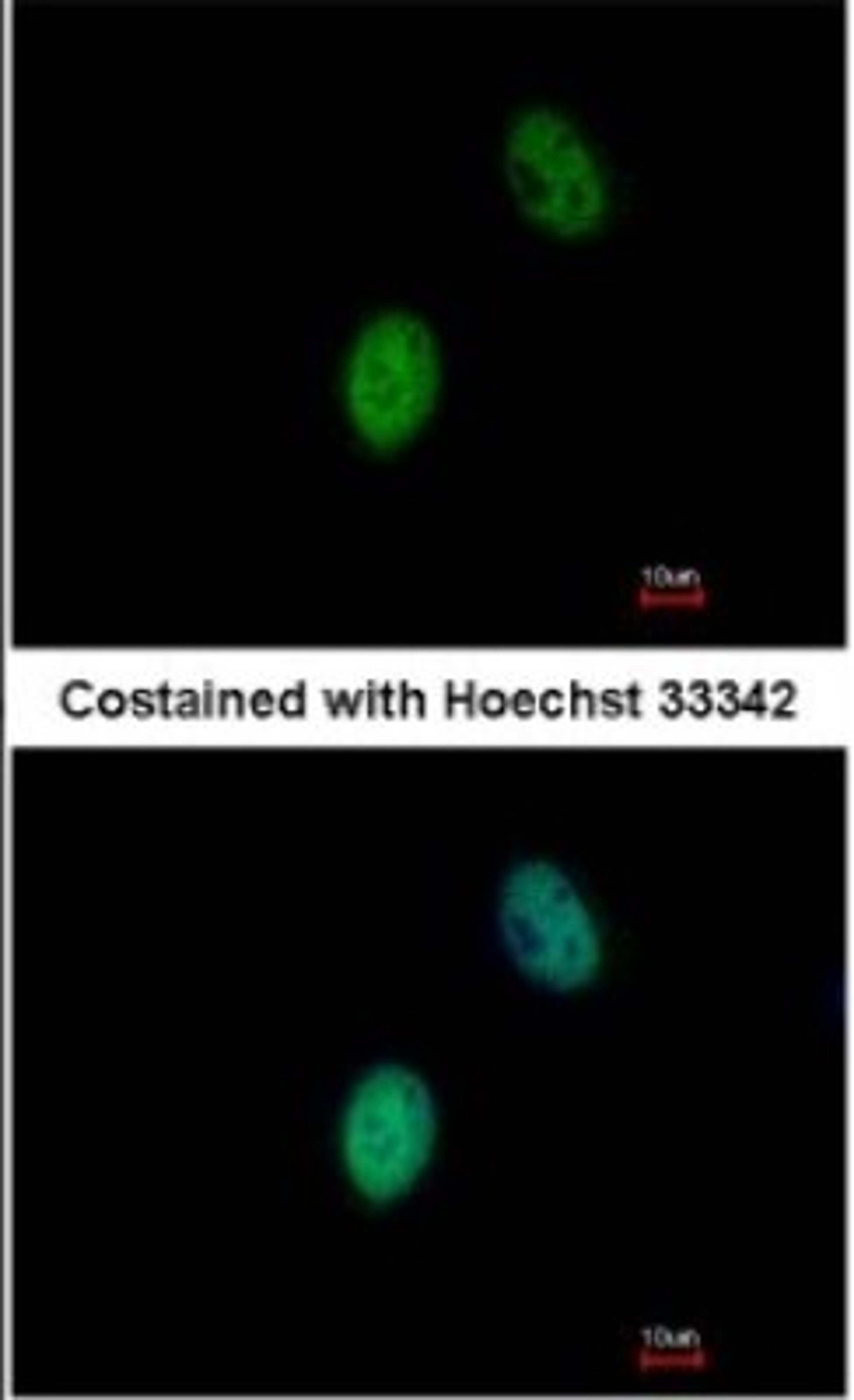 Immunocytochemistry/Immunofluorescence: FHL5 Antibody [NBP1-32660] - Paraformaldehyde-fixed HeLa, using antibody at 1:500 dilution.