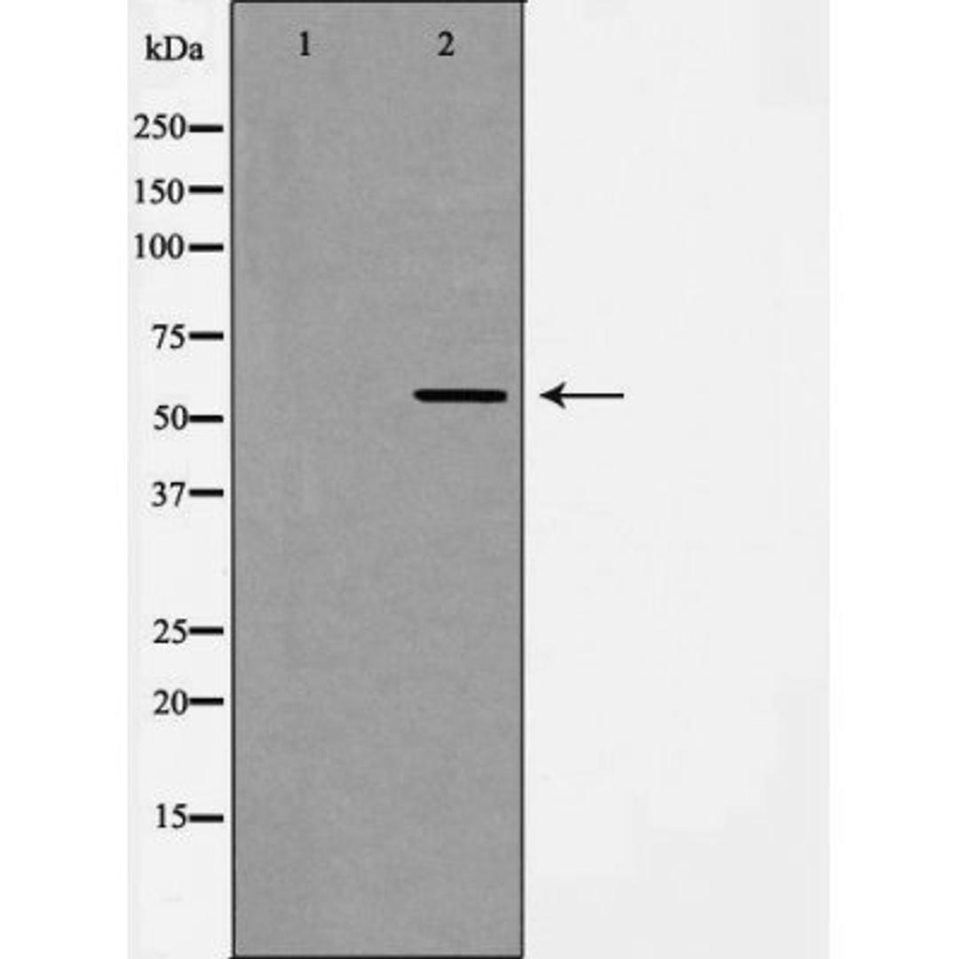 Western blot analysis of HUVEC cell lysate using ANG 2 antibody