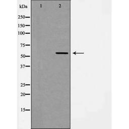 Western blot analysis of HUVEC cell lysate using ANG 2 antibody