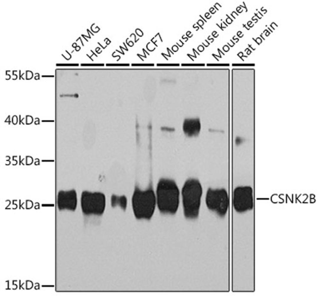 Western blot - CSNK2B Rabbit pAb (A14722)