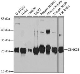 Western blot - CSNK2B Rabbit pAb (A14722)