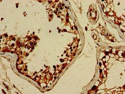 Immunohistochemistry of paraffin-embedded human testis tissue using CSB-PA866300LA01HU at dilution of 1:100
