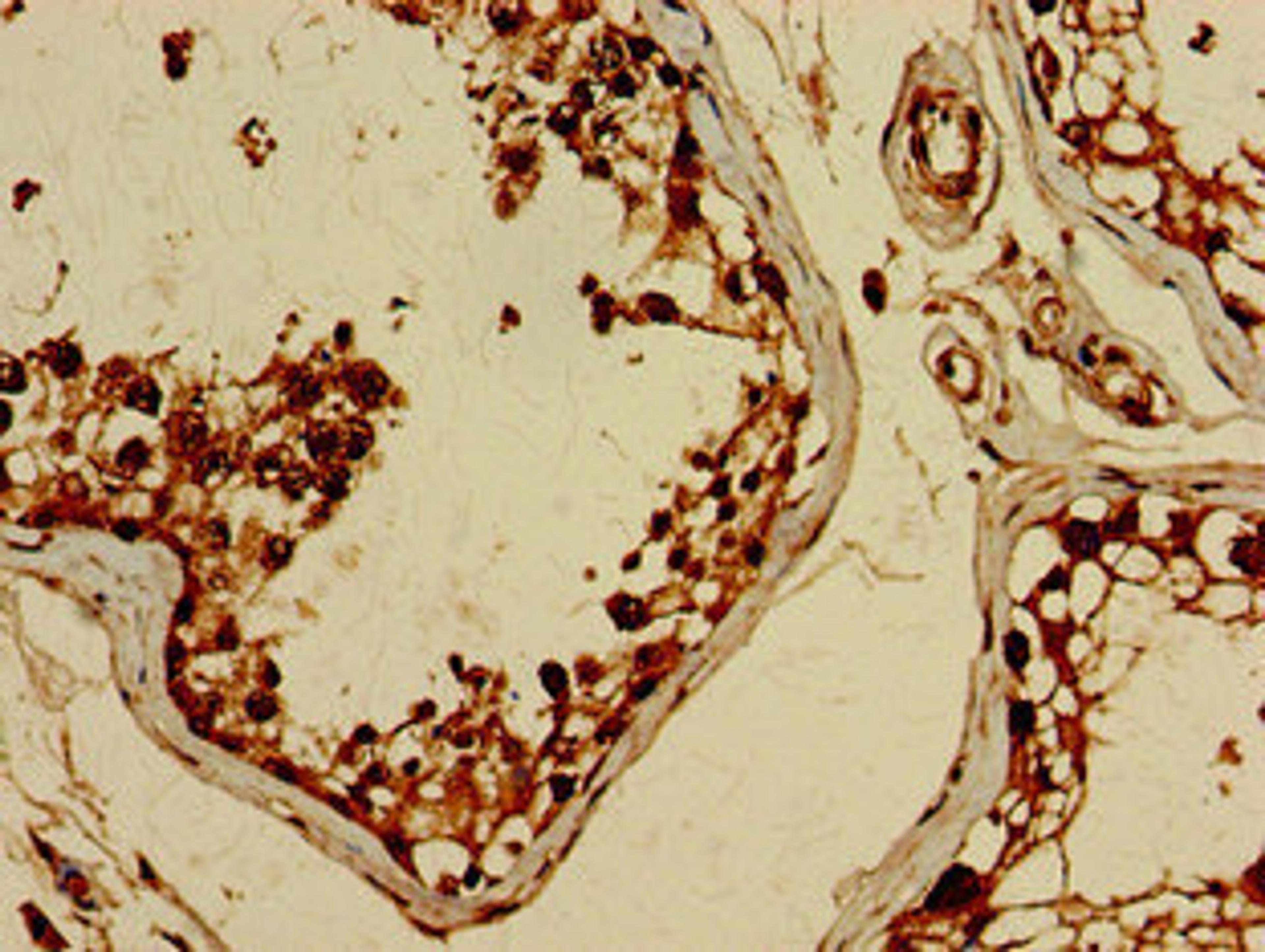 Immunohistochemistry of paraffin-embedded human testis tissue using CSB-PA866300LA01HU at dilution of 1:100