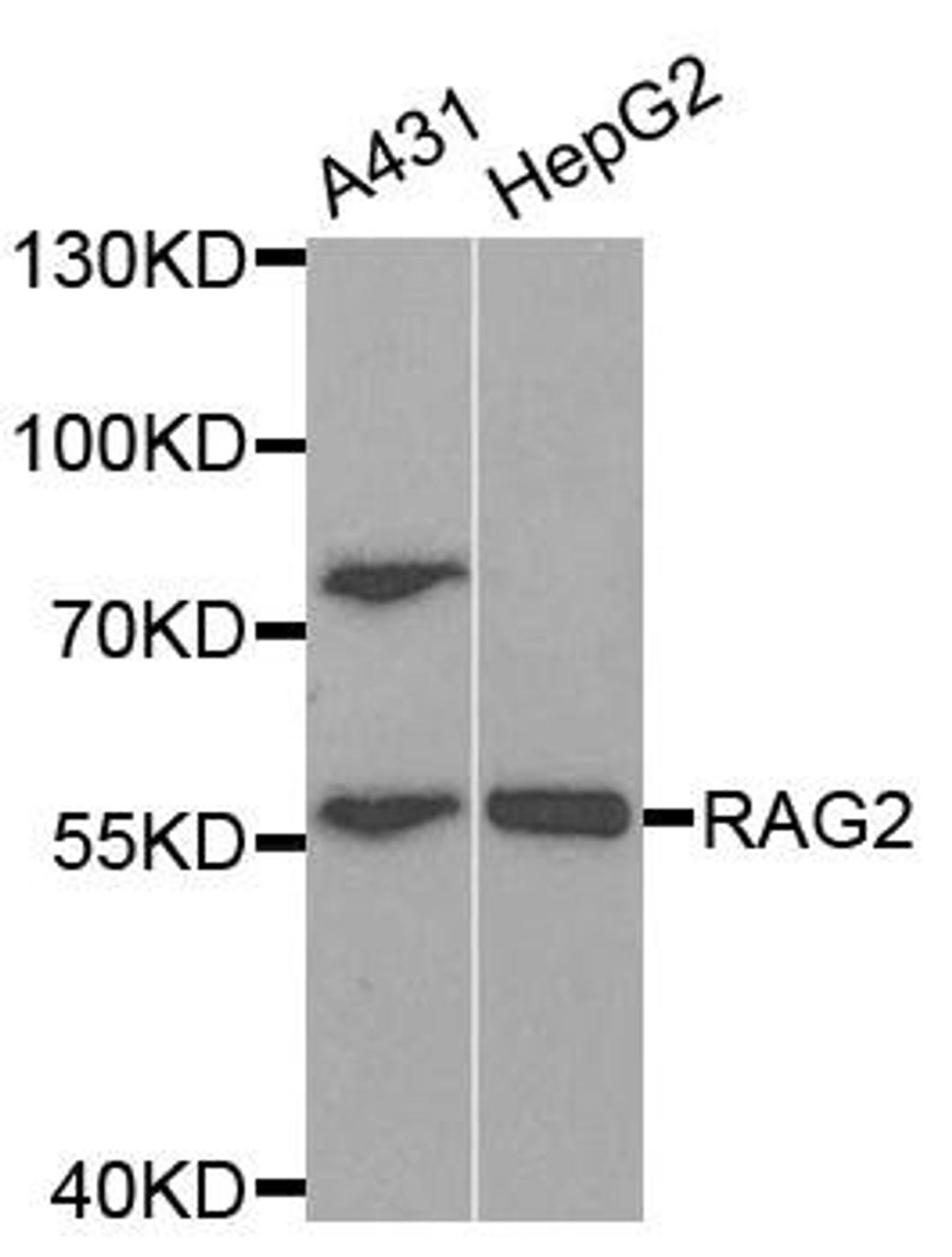 Western blot analysis of extracts of various cell lines using RAG2 antibody