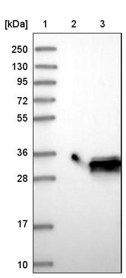 Western Blot: MTHFS Antibody [NBP1-83161] - Lane 1: Marker [kDa] 250, 130, 95, 72, 55, 36, 28, 17, 10<br/>Lane 2: Negative control (vector only transfected HEK293T lysate)<br/>Lane 3: Over-expression lysate (Co-expressed with a C-terminal myc-DDK tag (~3.1 kDa) in mammalian HEK293T cells, LY416629)