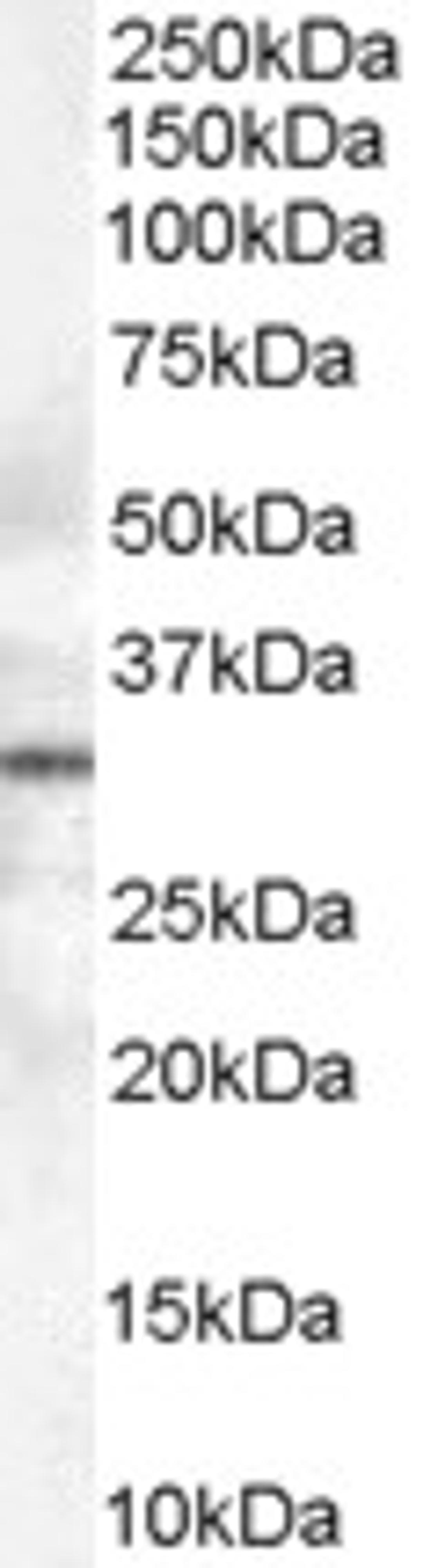 46-449 (0.3ug/ml) staining of human lymph node lysate (35ug protein in RIPA buffer). Primary incubation was 1 hour. Detected by chemiluminescence.