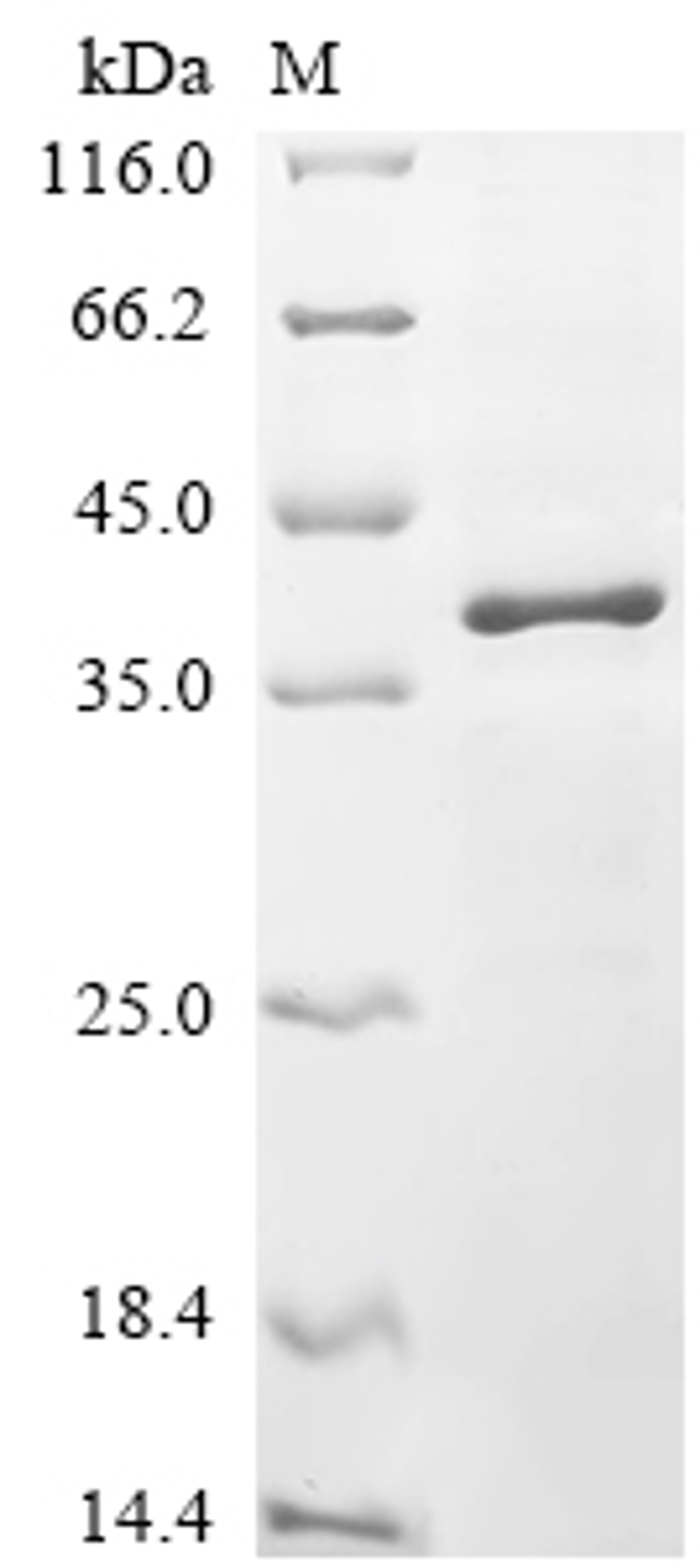 (Tris-Glycine gel) Discontinuous SDS-PAGE (reduced) with 5% enrichment gel and 15% separation gel.