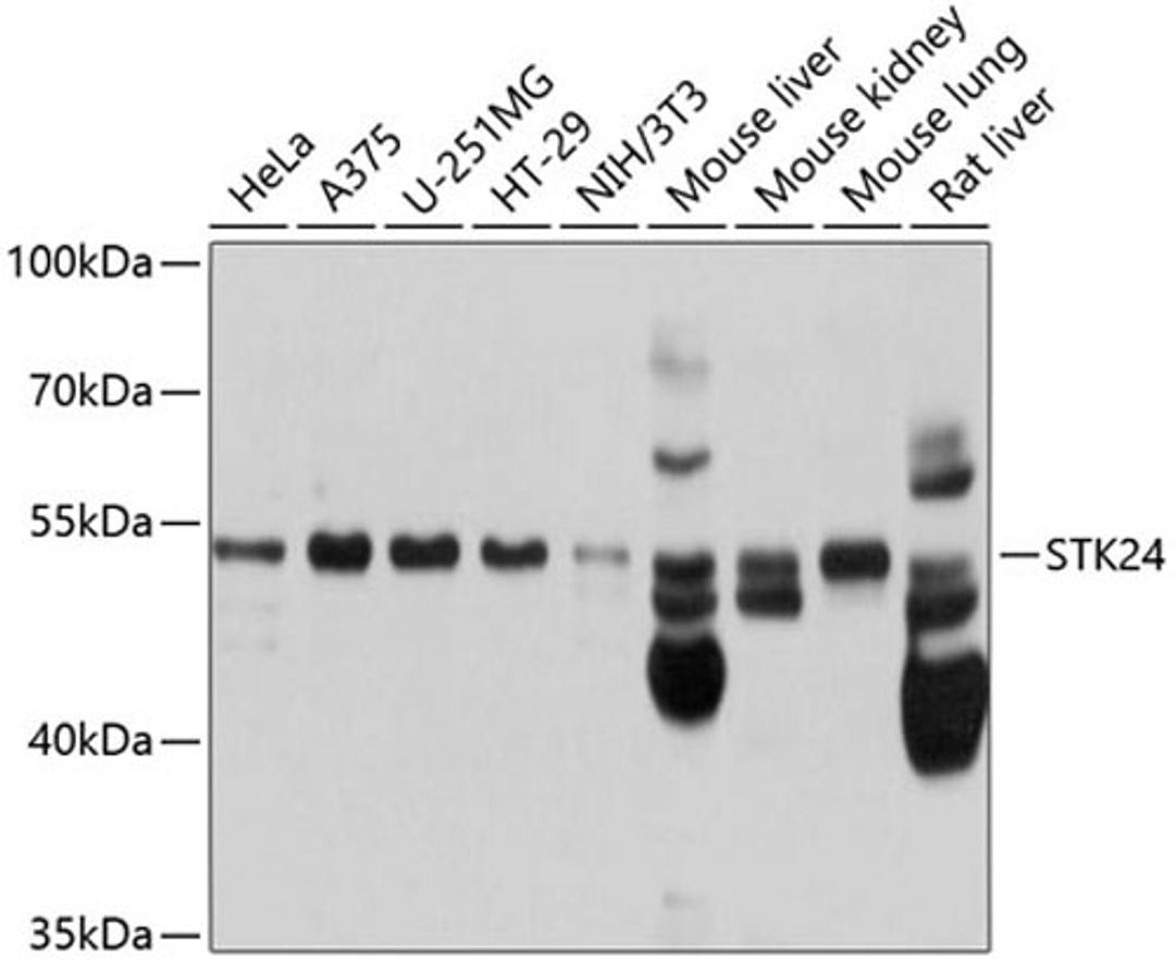 Western blot - STK24 antibody (A10576)