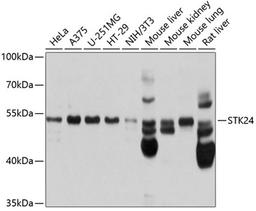 Western blot - STK24 antibody (A10576)