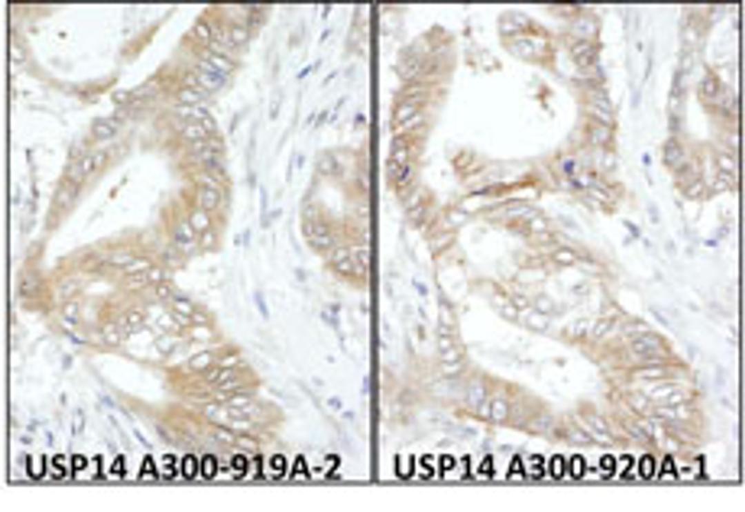 Detection of human USP14 by immunohistochemistry.