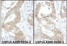 Detection of human USP14 by immunohistochemistry.