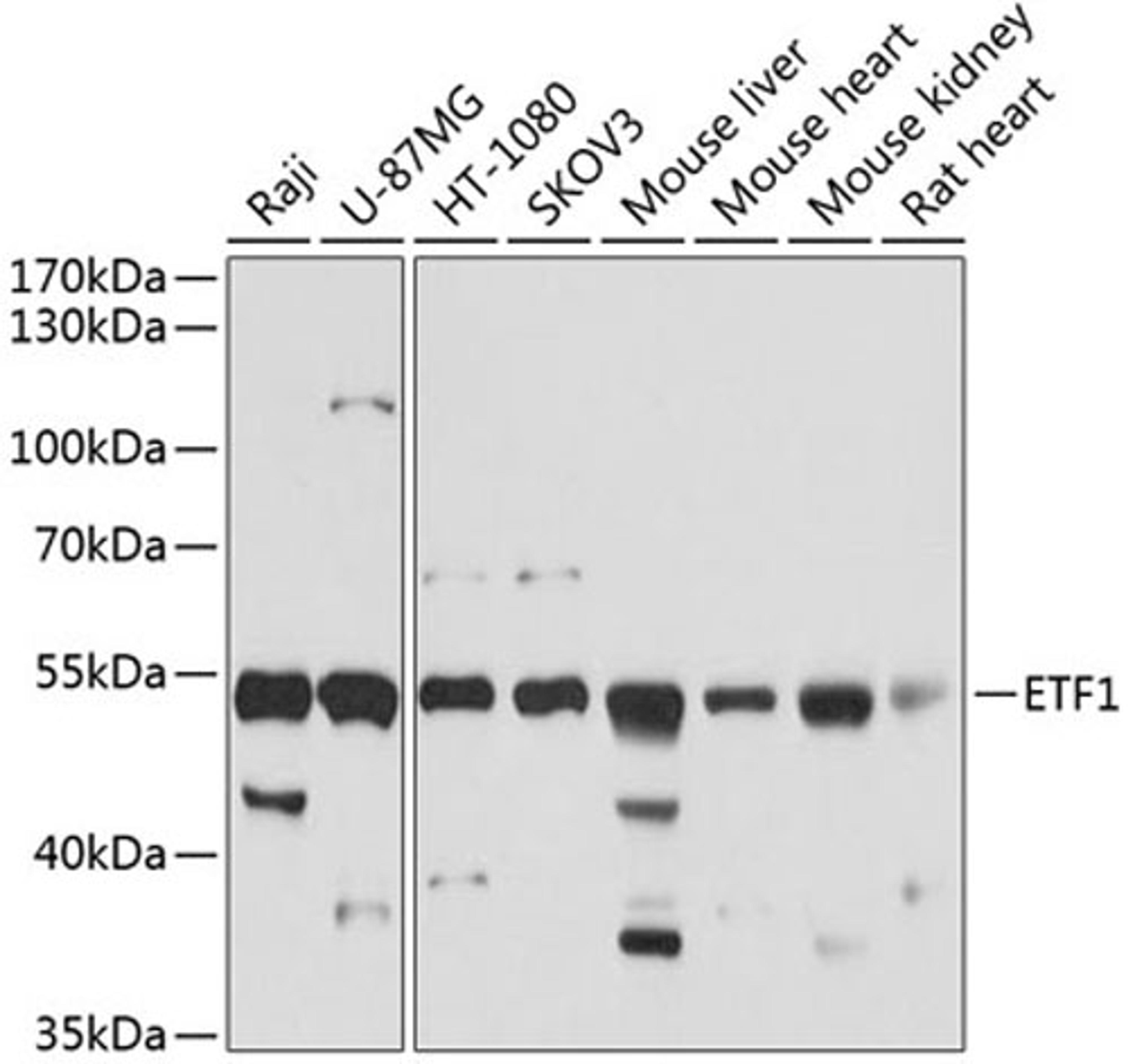 Western blot - ETF1 antibody (A5920)